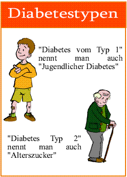 Diabetes Typen