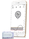 DexcomG5