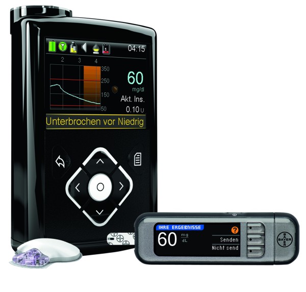 640G System CGM Contour