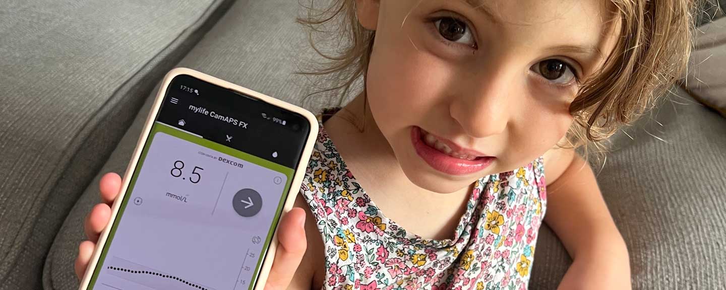 mylife loop banner emmi testimonial